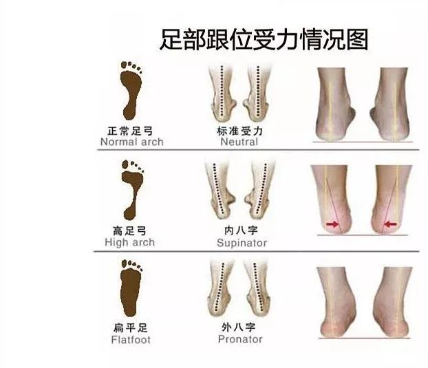 练就笔直大长腿，OX腿型如何应对？！｜运动康复003课