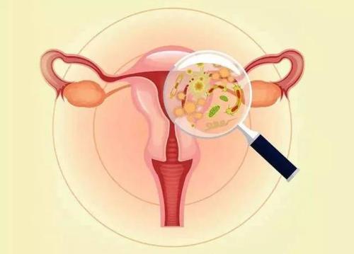 月经前白带增多是正常症状吗,月经来潮前白带有点黄是正常的吗