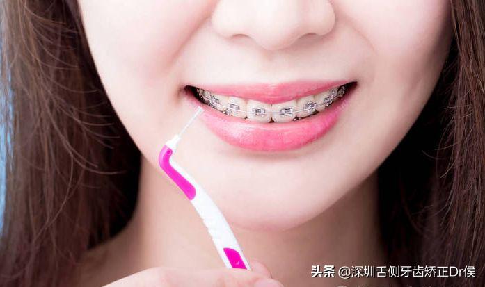 牙齿牙根没长全该怎样护理,《牙齿》护理攻略