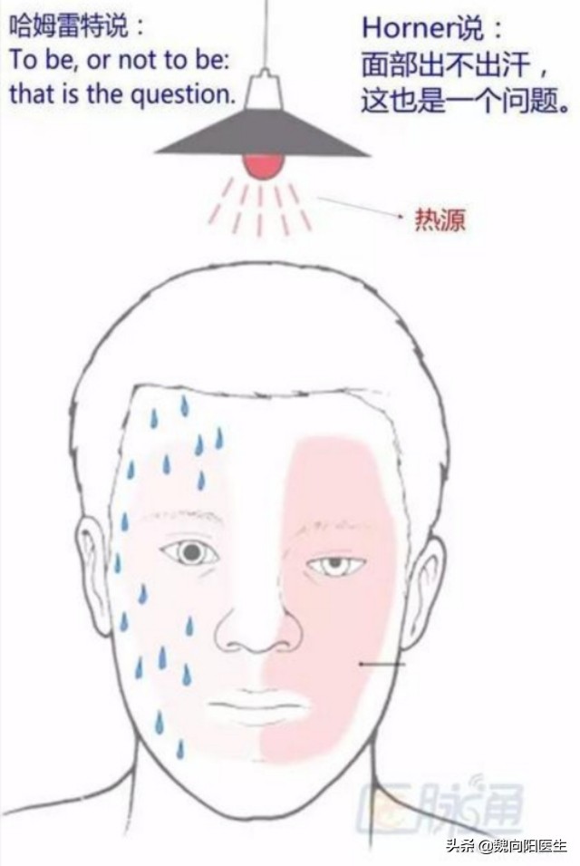 颈动脉闭塞血管夹层,颈动脉夹层是什么原因形成的