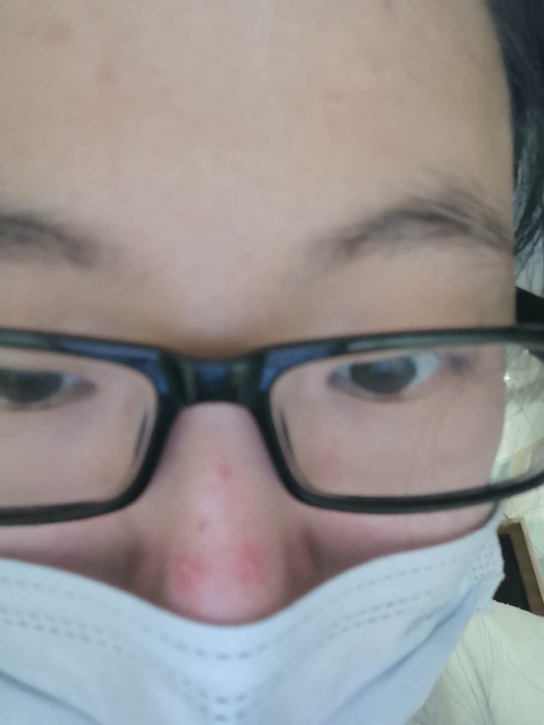 医心：我的红鼻子和酸鼻子