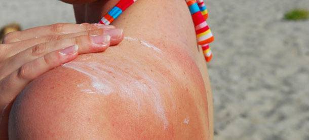 晒后皮肤疼如何快速修复,晒伤后出的晒痕如何处理