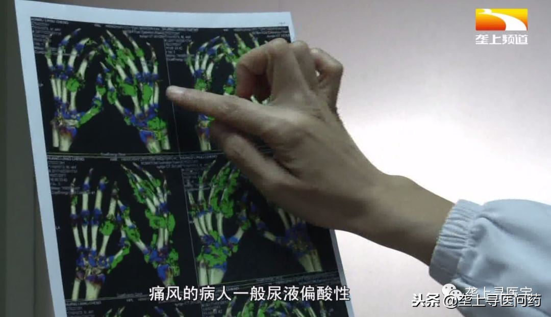 尿液可以保留多久才能做尿检,尿检前一天晚上需要注意什么