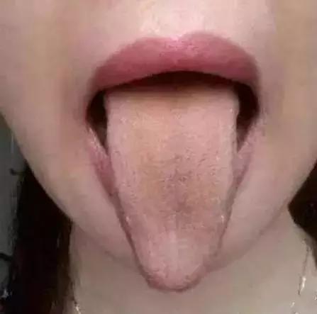 老中医提醒舌头4种异常,舌头一旦出现这个信号马上找中医