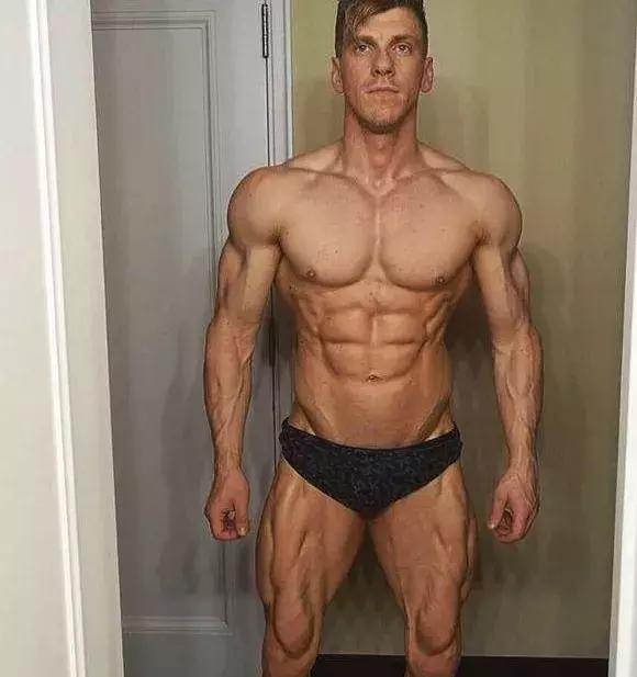 26岁健美冠军小腿静脉爆裂,22岁小伙健身过猛导致内脏撕裂