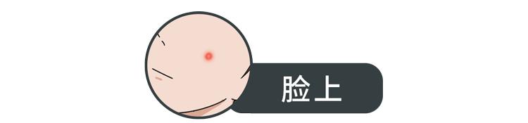 不同部位长痘痘的原因及解决方法,不同地方长痘痘的原因和改善方法