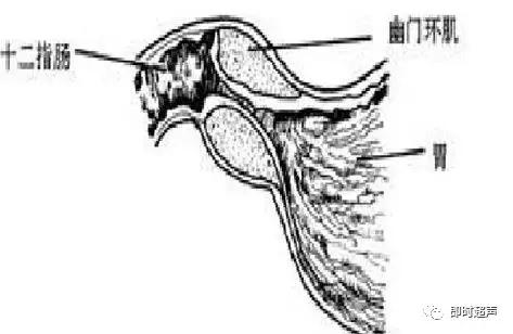 小儿消化道急症超声