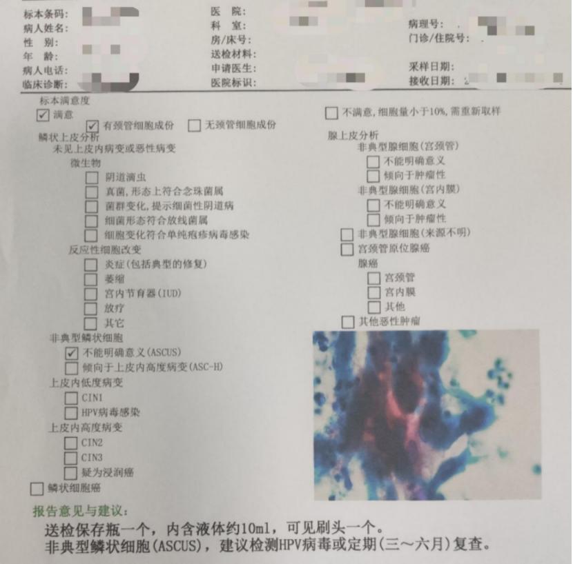 妇科tct报告如何解读,tct几天能拿报告