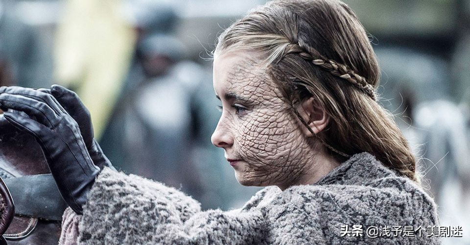 《权力的游戏》既然灰鳞病是一种致死疾病，为何还能让人治愈呢？