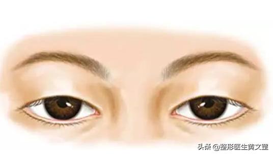 黑眼珠一定是圆吗,黑眼珠全部露出来眼睛大吗