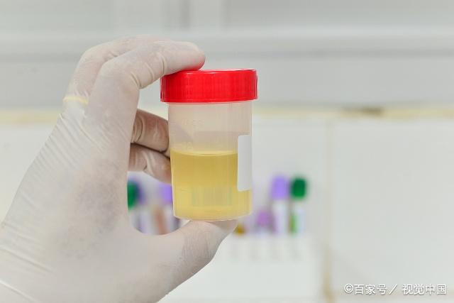 总小便是怎么回事吃什么药,总是小便频繁是什么原因