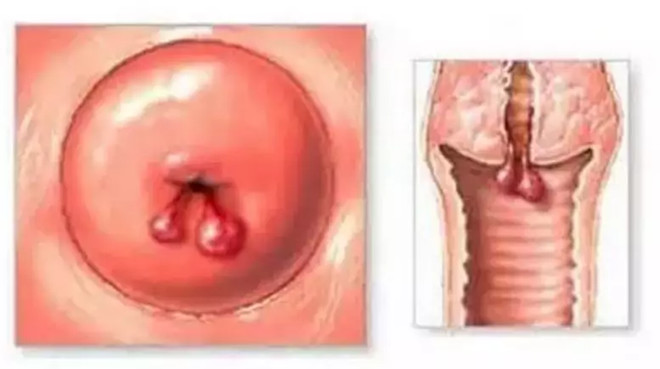 好文收藏|得了妇科病，还能买保险吗？