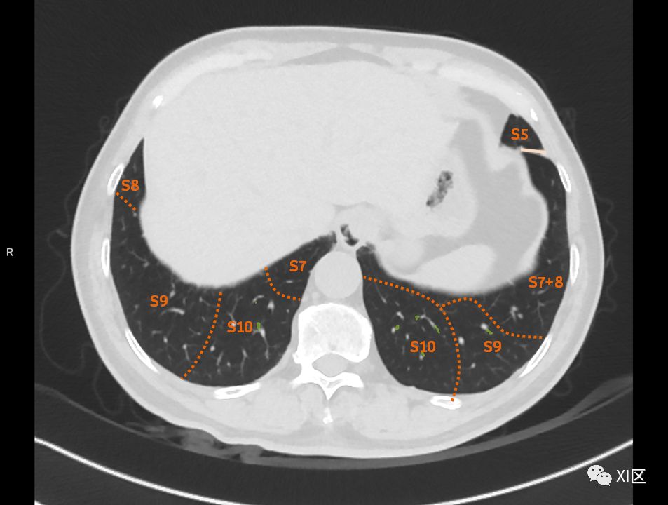 如此详细的肺部影像解剖，有点儿酷！