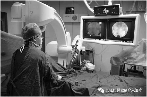 倪海厦治疗输卵管堵塞,输卵管堵塞该如何治疗