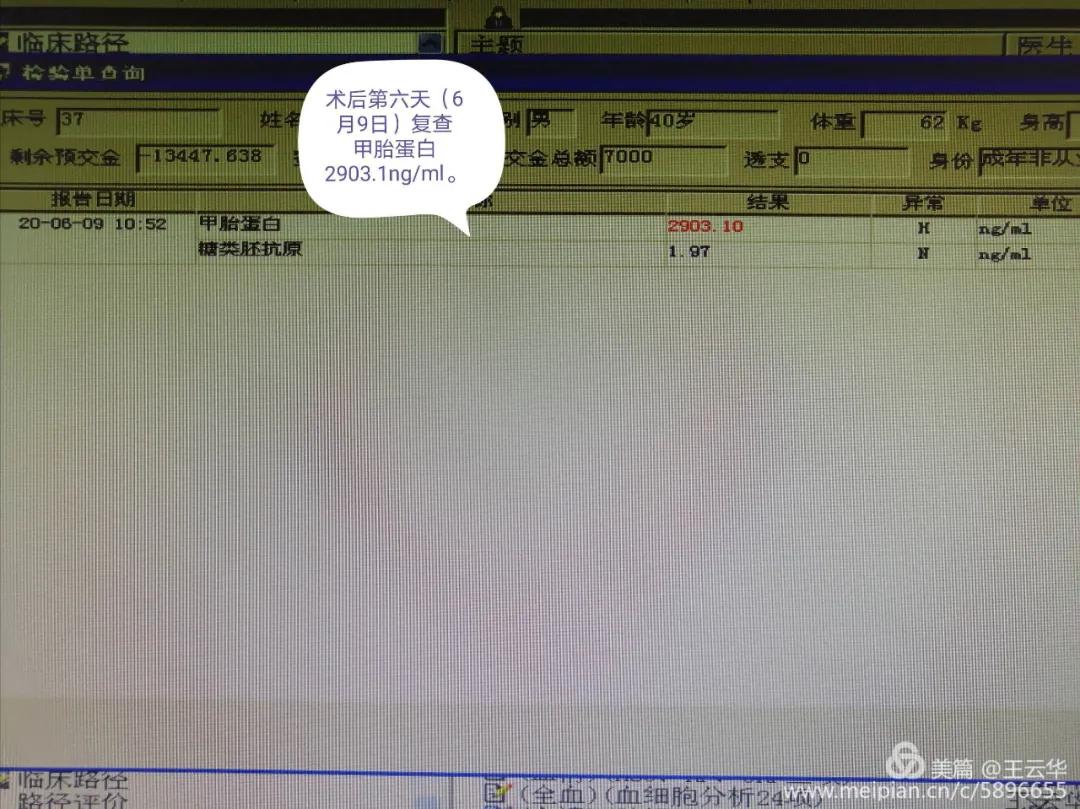 楚雄州人民医院肝胆外二科,四川省人民医院肝胆外科治疗肝癌