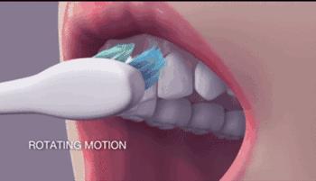 牙齿上火牙龈痛怎么止痛,牙龈肿是牙齿坏了还是上火引起的