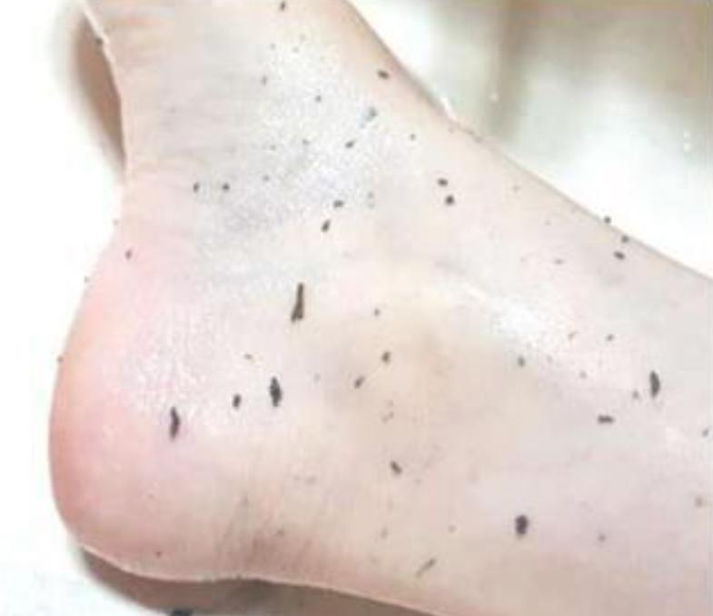 洗澡的时候搓出来的泥是什么,搓澡下来的白条是什么