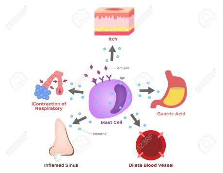 人工荨麻疹皮肤划痕症怎么治,人工荨麻疹皮肤划痕症怎么治疗