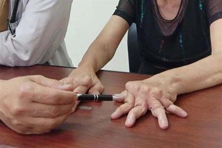 类风湿性关节炎被称为不死的癌症,类风湿为何称不死的癌症