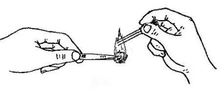 神经性皮炎针灸治疗视频,火针治疗神经性皮炎的教学视频