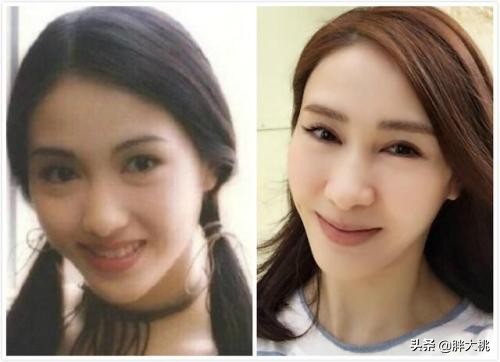 透明质酸和玻尿酸有什么区别,透明质酸跟玻尿酸是一个东西吗