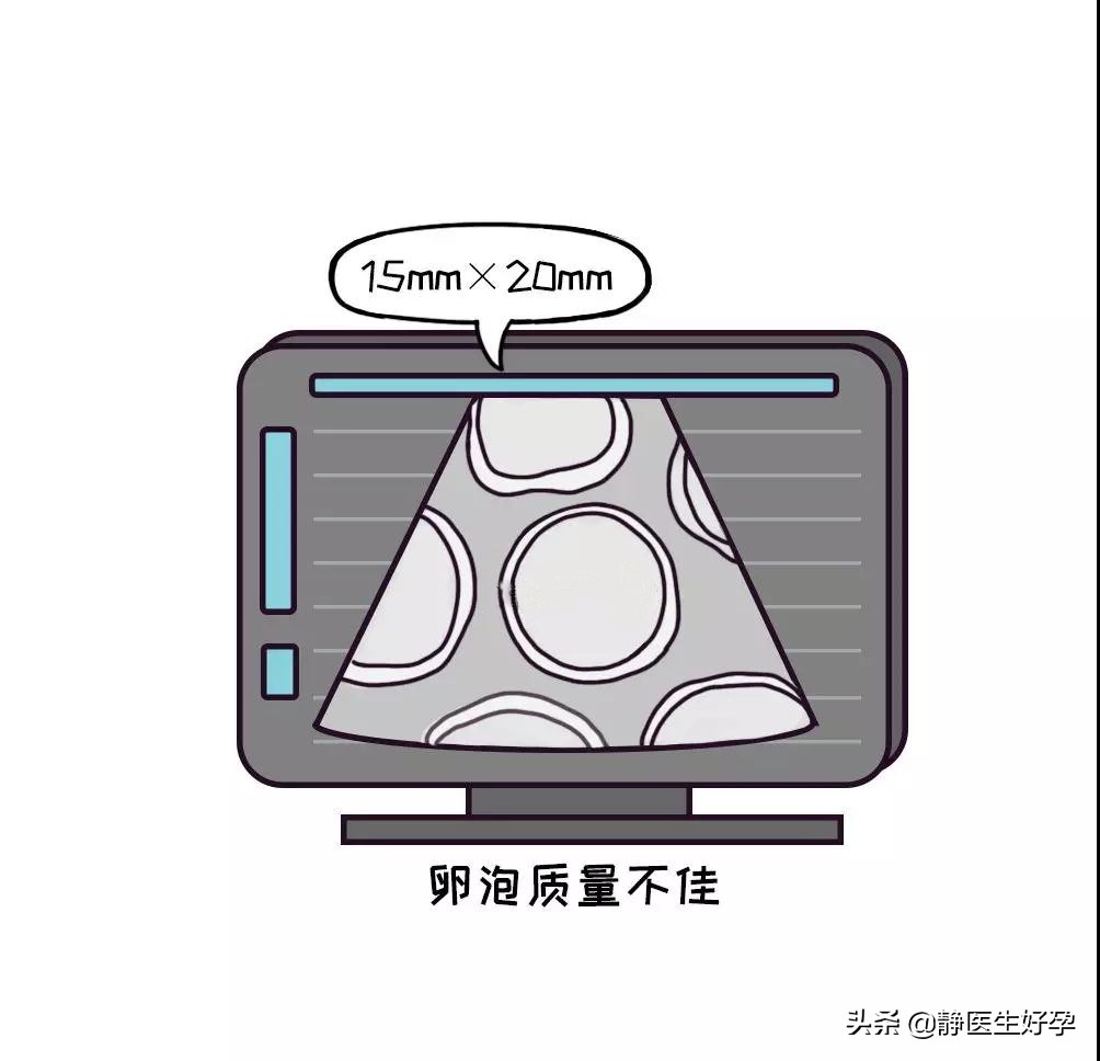 静医生备孕：只需一招，就能帮你把卵泡养的又大又好！