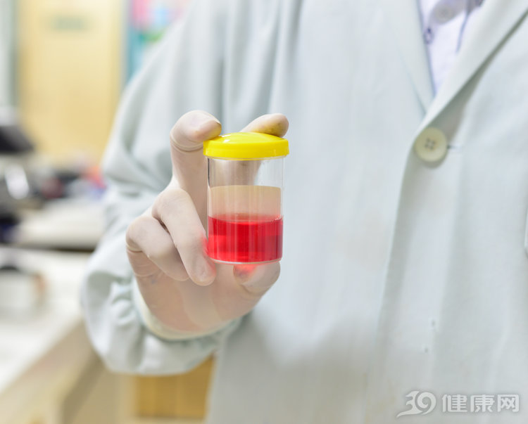 尿蛋白提示neg,尿蛋白会误诊吗