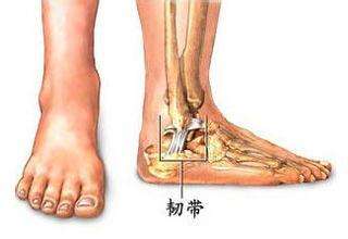 膝盖内侧副韧带拉伤怎么办恢复快,韧带拉伤喷云南白药气雾剂有效吗