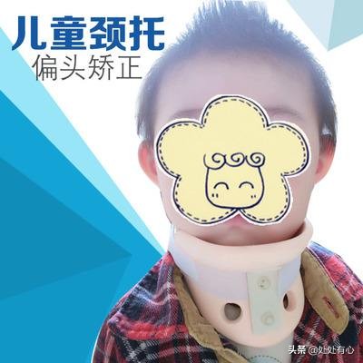 16岁偏头如何纠正,如果偏头严重怎么办