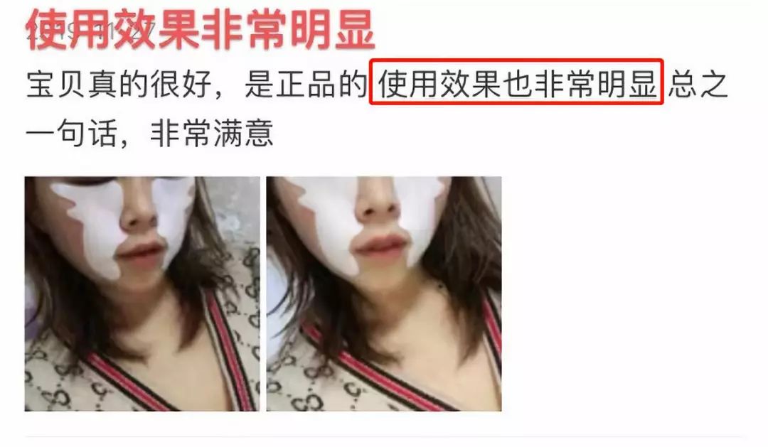 改善眼角细纹的方法有哪些,眼角皱纹细纹怎么去掉