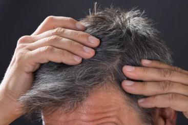 女人年轻头发白是缺少什么,女性白头发是因为缺什么