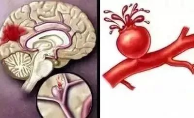 倒春寒冻手冻脚,倒春寒感冒会留下病根