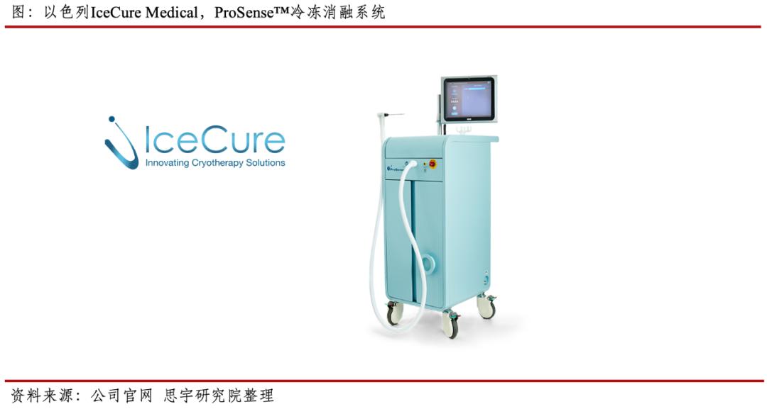肿瘤冷冻消融治疗方法,肿瘤冷冻消融分析