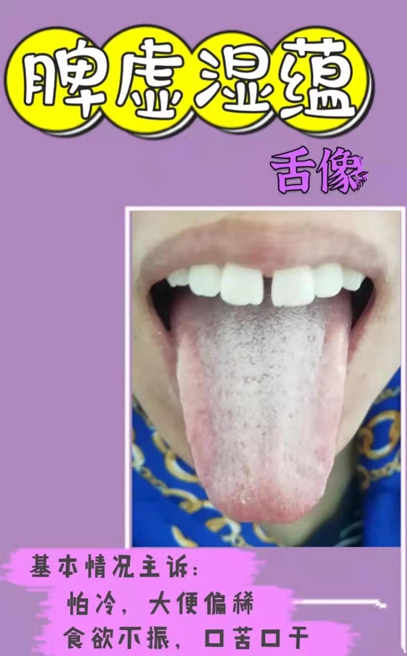 健脾胃治脾胃不和中成药,脾胃不好百病生怎么办