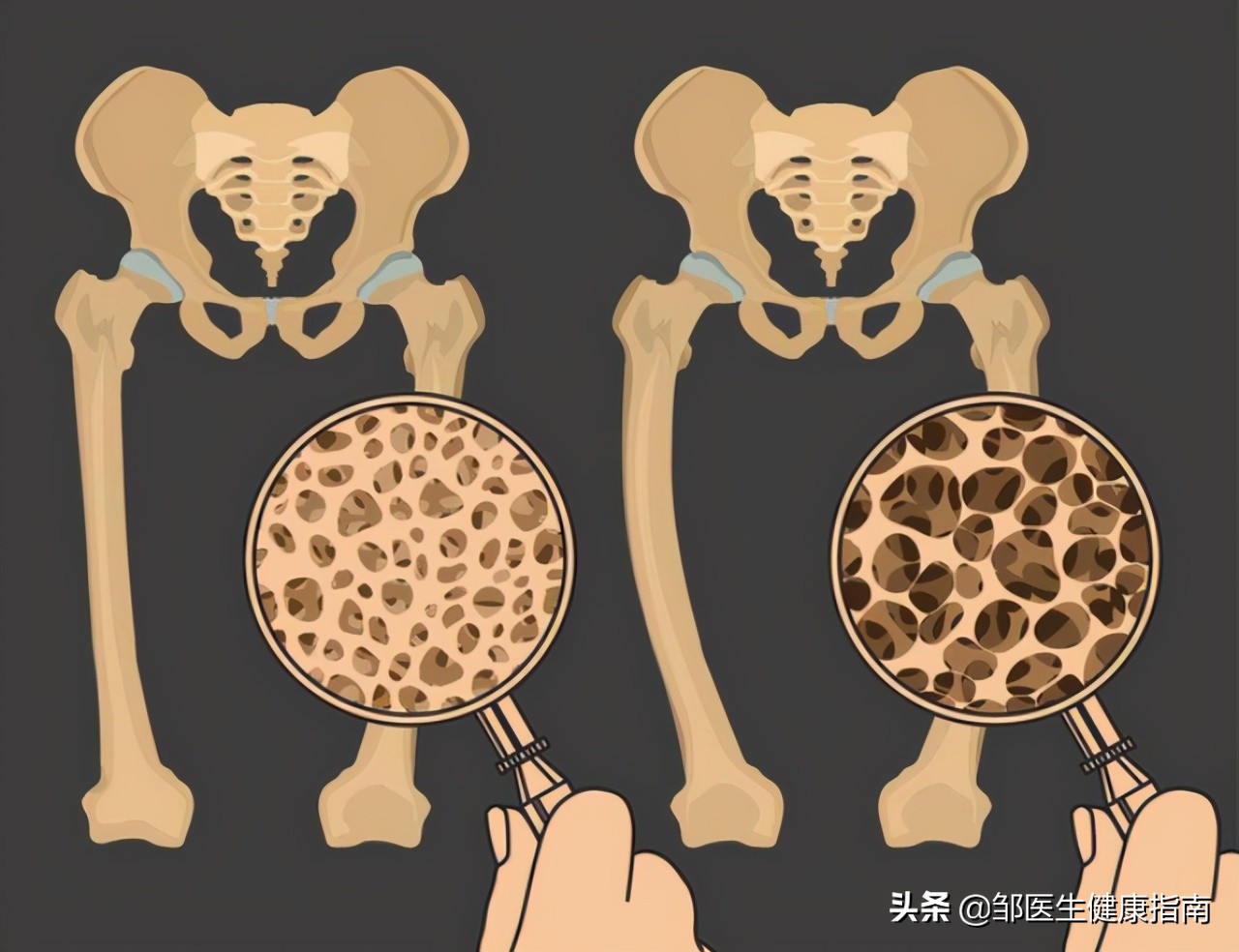 为什么说女人50是个坎,55岁下肢无力而且疼是怎么回事