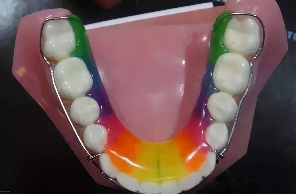 郑州有名的正畸医生蔡留意,郑州蔡留意医生到底怎么样