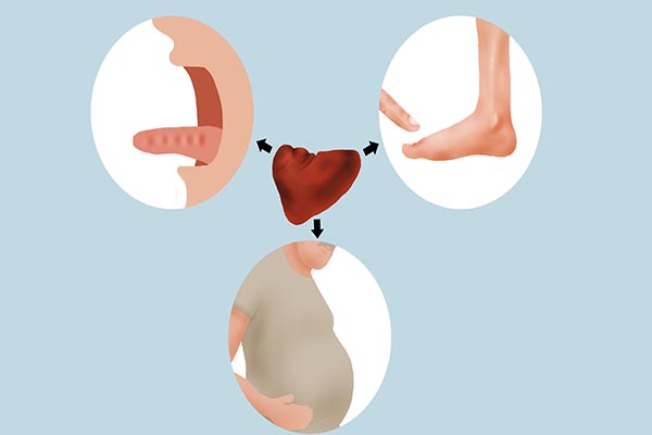 脾一虚全身出问题,脾太过虚弱会造成什么样的后果