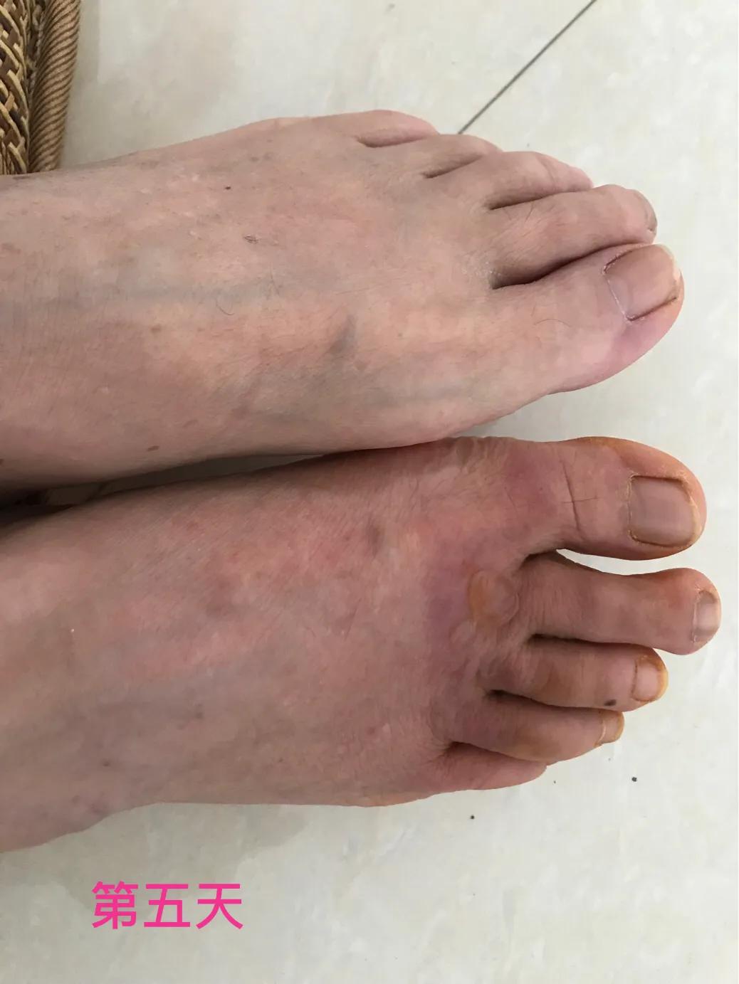 自己用中药熬的面膜靠谱吗,自己用中药做的面膜好吗