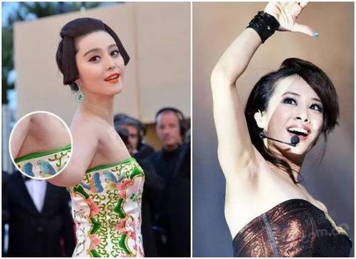 皮肤黑对脱毛效果有影响吗,脱毛后皮肤很黑怎么办