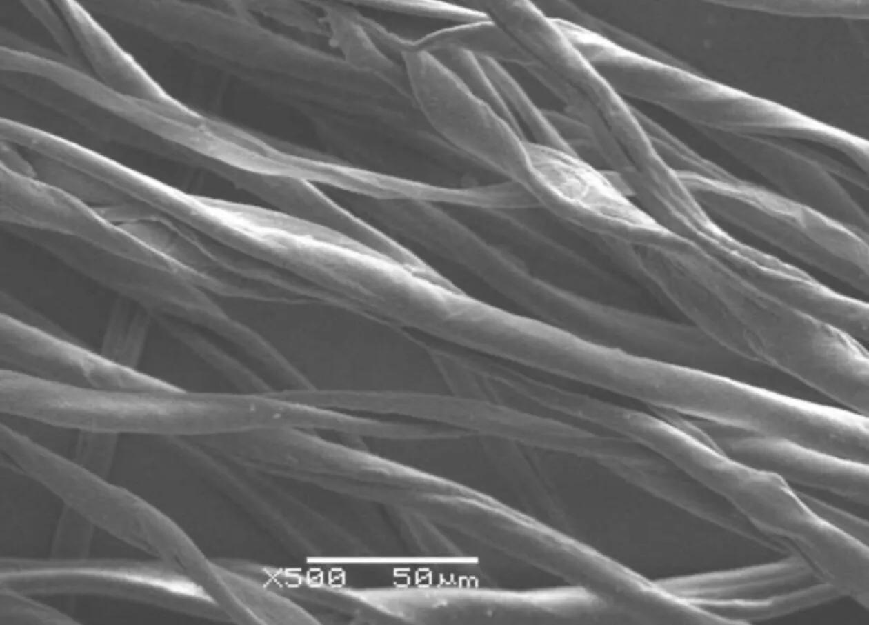 房间里总是有很多毛毛是什么原因,家里每天打扫还是有很多毛毛