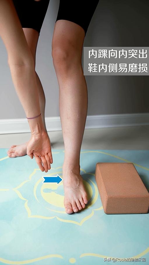 脚踝受限跛脚如何纠正,脚受伤后怎么锻炼脚踝的灵活性