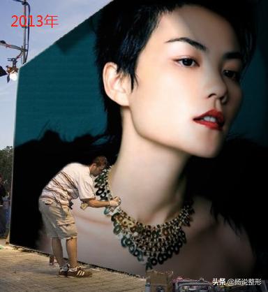 隆鼻整容老了会怎么样,隆鼻后老了