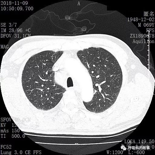 怎么应用统计学做调查,统计学方法可以解决的主要问题