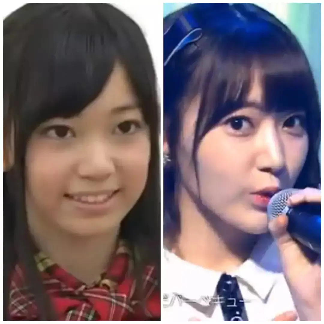 日本整容的鬼斧神工，来见识一下各位日星是整容了还是“长开”了