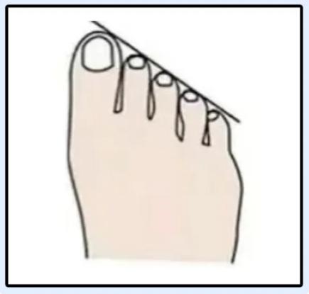 磨脚鞋不合脚,磨脚是因为鞋小吗