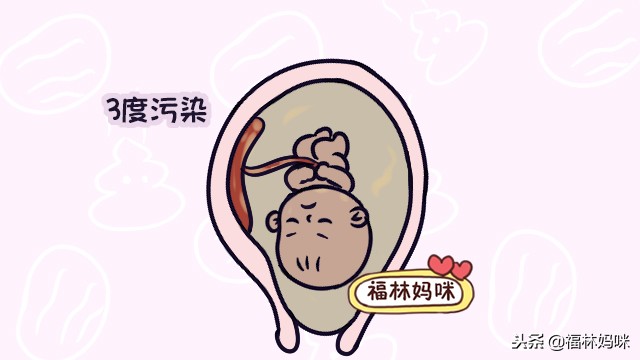 孕晚期羊水略浑浊怎么办,孕晚期什么情况会引起羊水浑浊