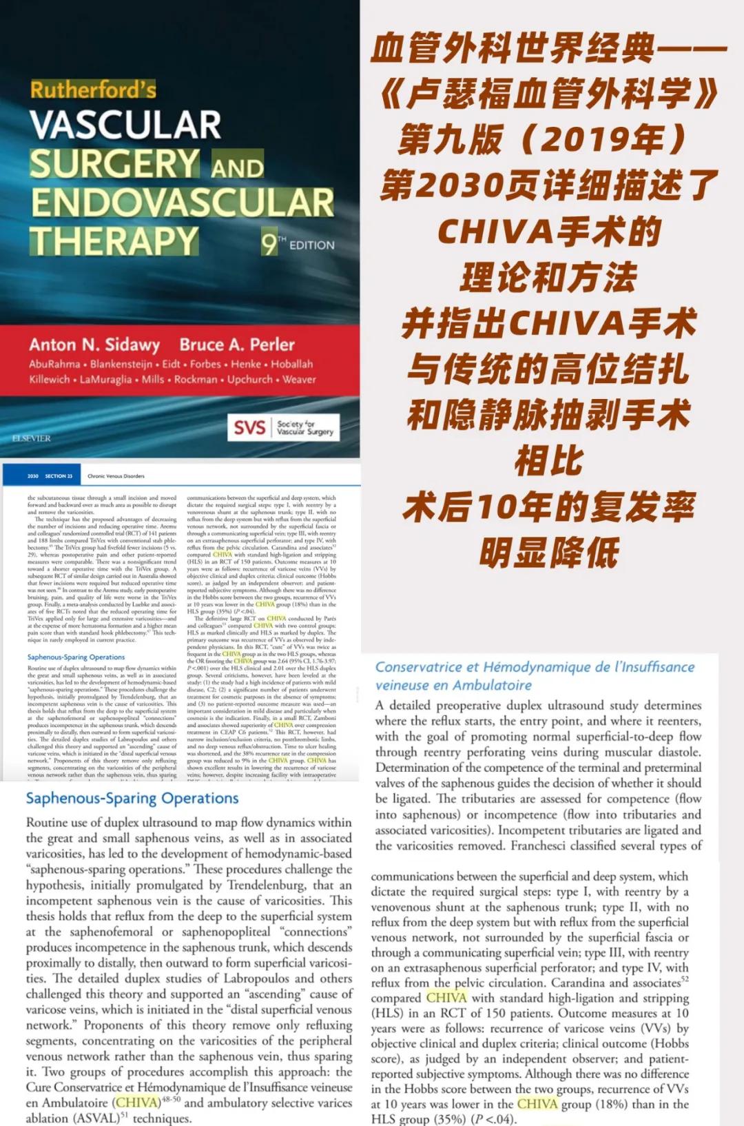 chiva治疗下肢静脉曲张价格,chiva治疗静脉曲张