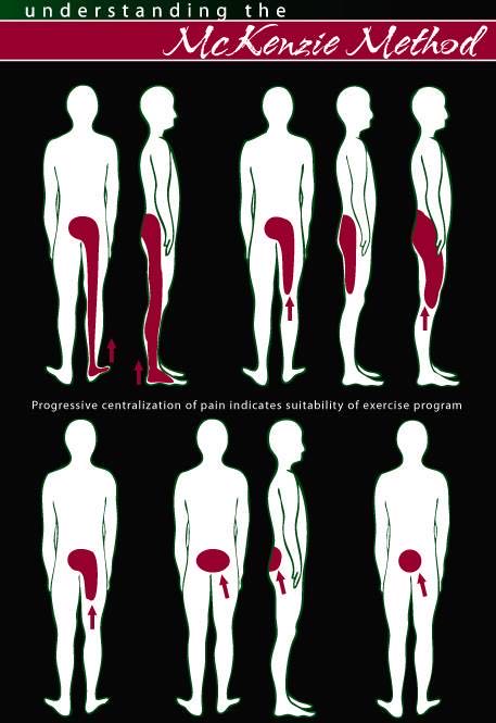 为什么腰椎间盘突出容易伤腰呢,为什么腰椎间盘膨出腿会疼