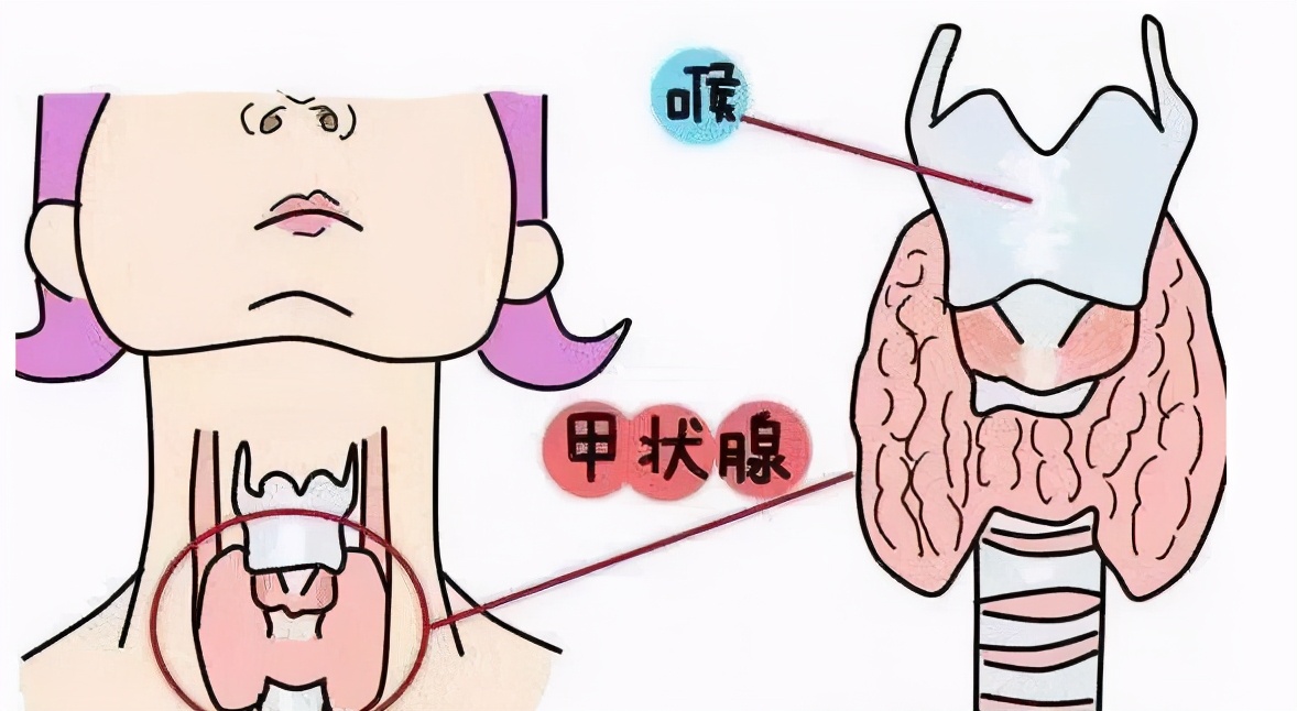 妊娠期桥本甲状腺炎怎么办,妊娠期甲状腺癌如何处理