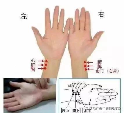 中医浮脉的脉象特征是什么,中医讲脉诊